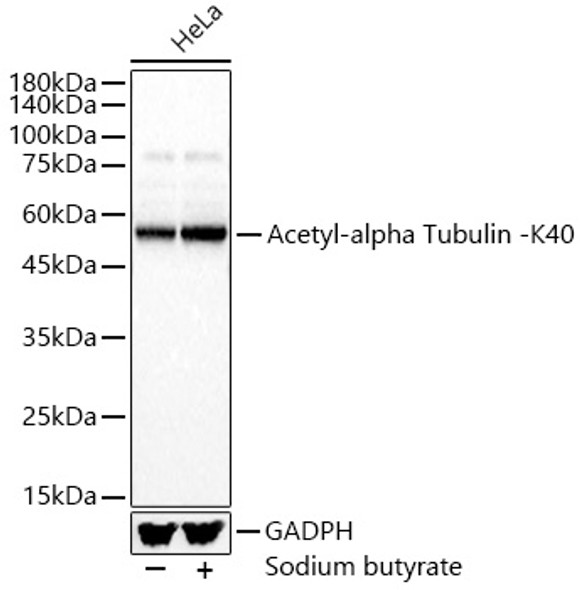 Acetyl-alpha Tubulin -K40 Polyclonal Antibody