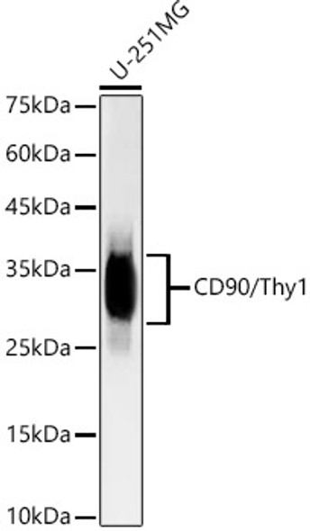 [KO/KD Validated] CD90/Thy1 Monoclonal Antibody