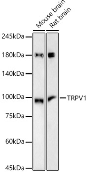 TRPV1 Monoclonal Antibody