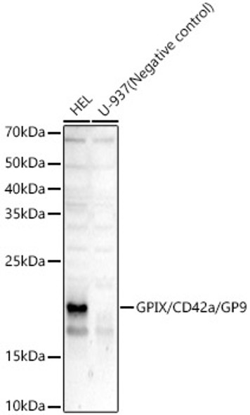 GPIX/CD42a/GP9 Monoclonal Antibody (CAB23421)