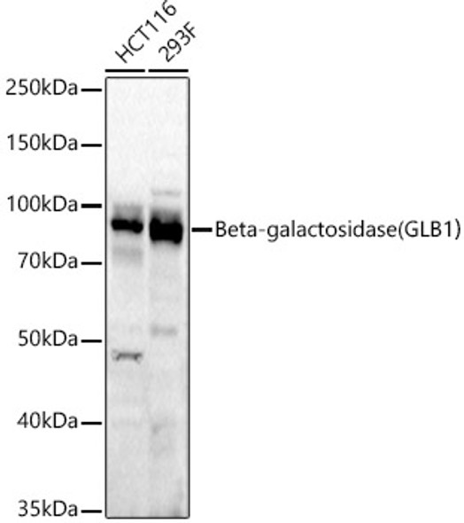 Beta-galactosidase （GLB1）Rabbit Monoclonal Antibody