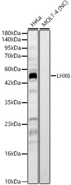 LHX6 Polyclonal Antibody