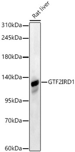 GTF2IRD1 Polyclonal Antibody