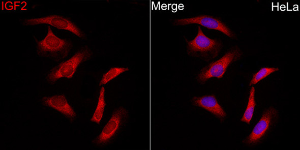 IGF2 Polyclonal Antibody