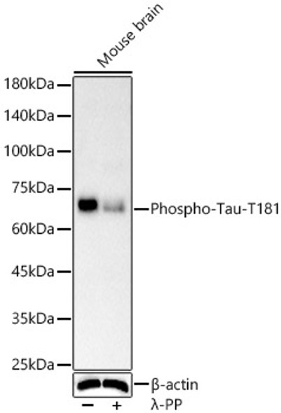 Phospho-Tau-T181 Monoclonal Antibody (CABP1387)