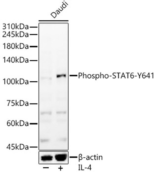Phospho-STAT6-Y1281 Monoclonal Antibody