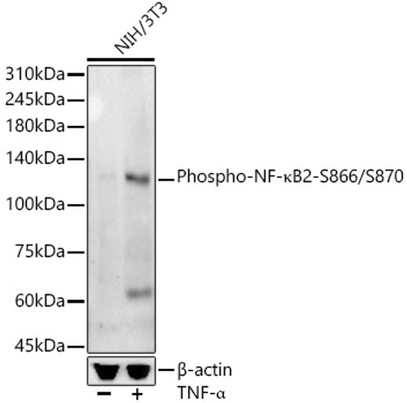 Phospho-NF-κB2-S866/S870 Monoclonal Antibody