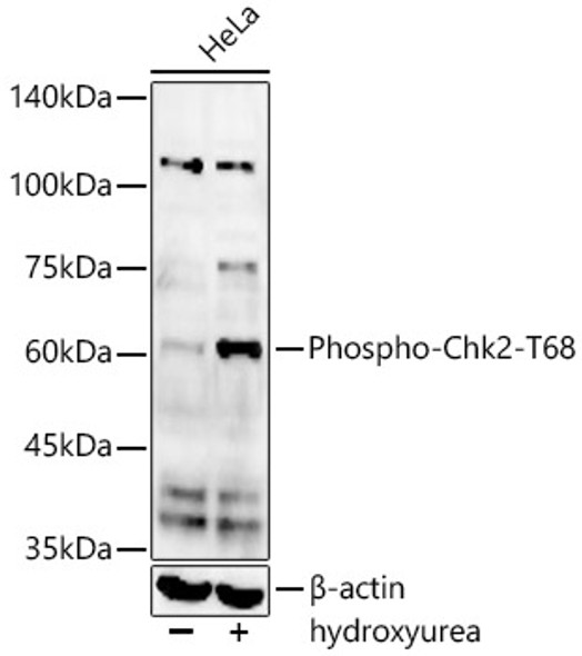 Phospho-Chk2-T68 Monoclonal Antibody (CABP1392)