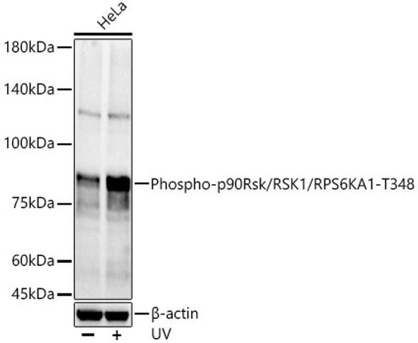 Phospho-p90Rsk/RSK1/RPS6KA1-T348 Polyclonal Antibody