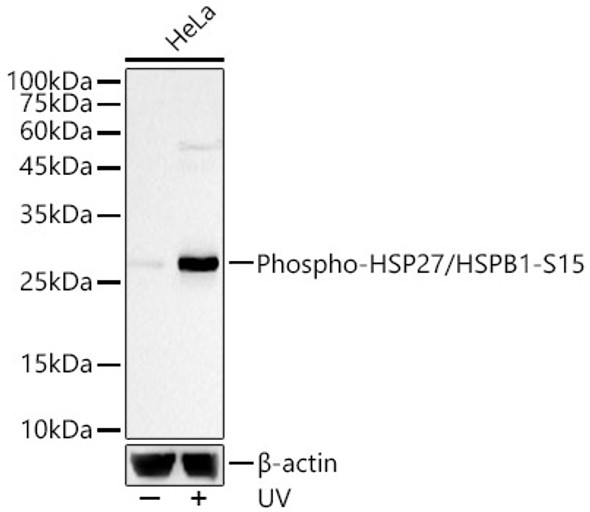 Phospho-HSP27/HSPB1-S15 Monoclonal Antibody