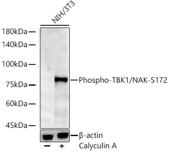 Phospho-TBK1/NAK-S172 Monoclonal Antibody
