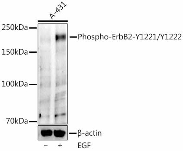 Phospho-ErbB2-Y1221/Y1222 Monoclonal Antibody