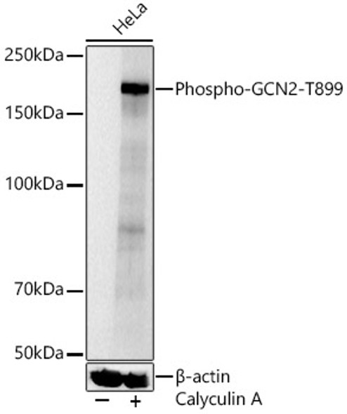 Phospho-GCN2-T899 Polyclonal Antibody