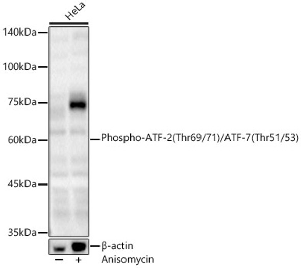 Phospho-ATF-2 (Thr69/71)/ATF-7 (Thr51/53) Polyclonal Antibody