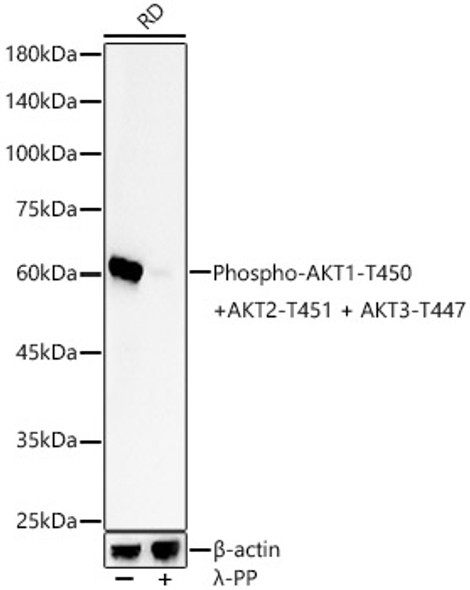 Phospho-AKT1-T450 + AKT2-T451 + AKT3-T447 Monoclonal Antibody