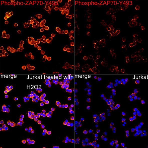 Phospho-ZAP70-Y493 Monoclonal Antibody