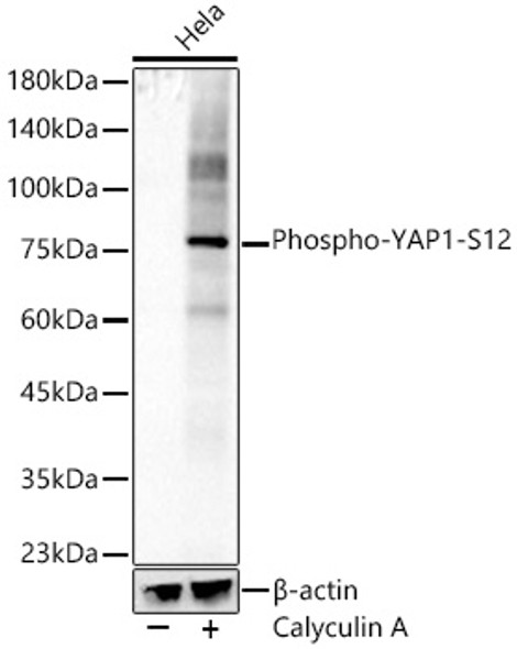 Phospho-YAP1-S127 Monoclonal Antibody