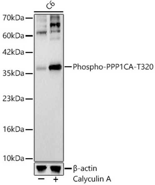 Phospho-PPP1CA-T320 Monoclonal Antibody