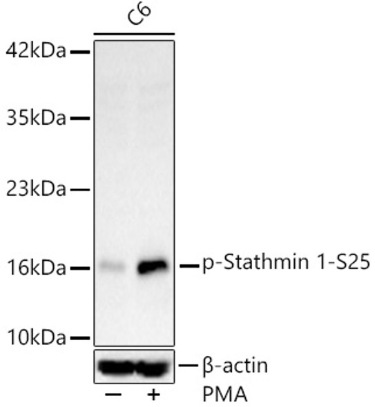 Phospho-Stathmin 1-S25 Monoclonal Antibody