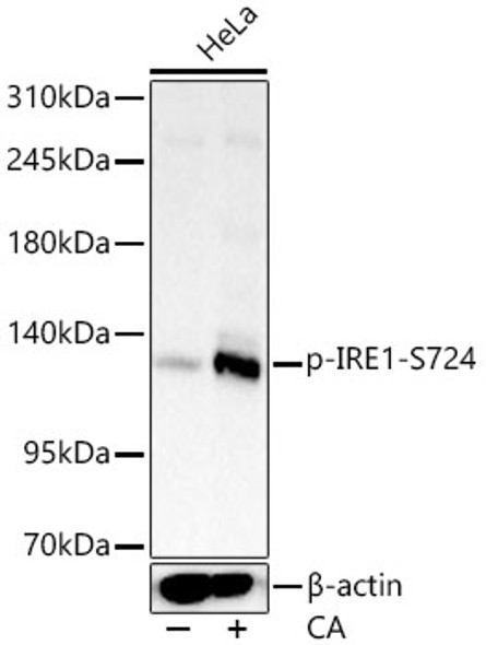 Phospho-IRE1-S724 Monoclonal Antibody
