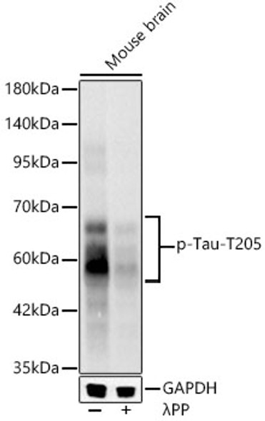 Phospho-Tau-T205 Monoclonal Antibody
