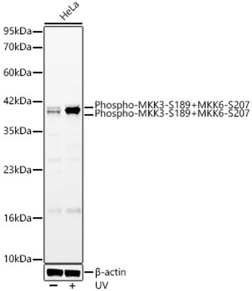 Phospho-MKK3-S189+MKK6-S207 Monoclonal Antibody (CABP1449)