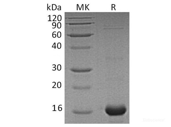 Human AIF1 Recombinant Protein (His Tag)