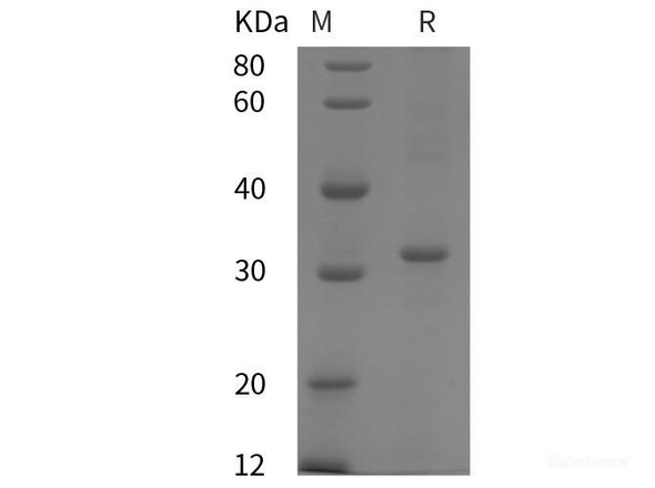 Human ALDOA Recombinant Protein (His tag)