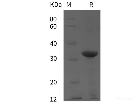 Human ADA Recombinant Protein (His tag)