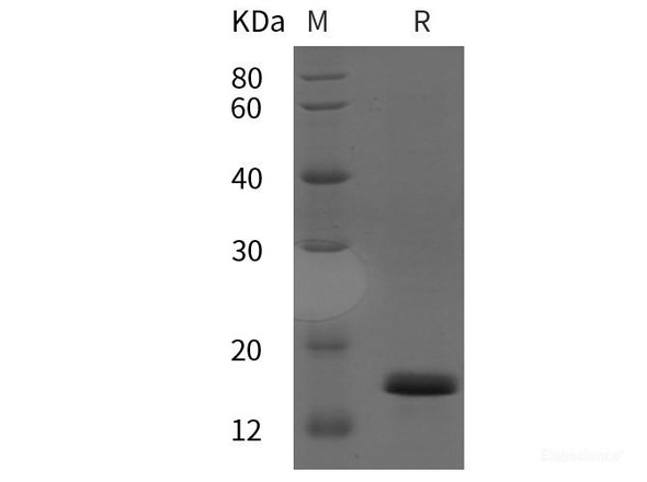 Human BMP-7 Recombinant Protein (His tag)