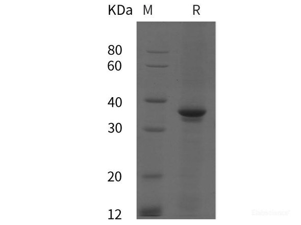 Human PⅢNP Recombinant Protein (His tag)