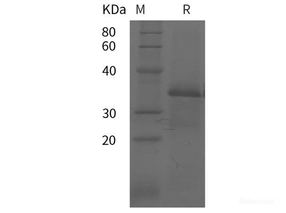 Human MUC5AC Recombinant Protein (GST tag) (RPES5486)