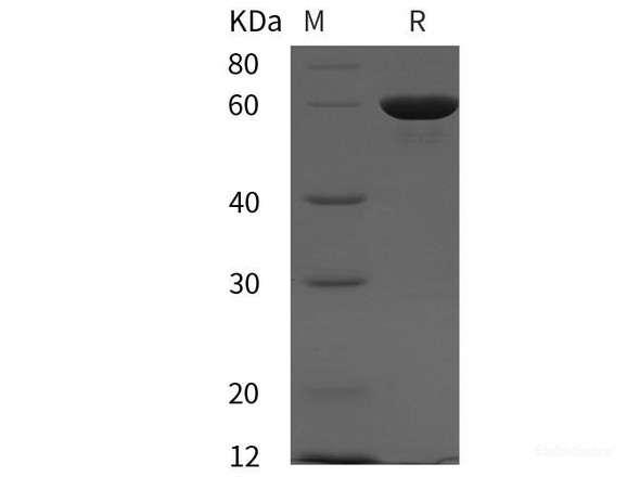 Human PTPN11 Recombinant Protein (His tag)