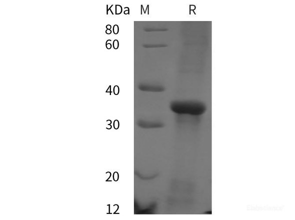 Human CD38/SCARB3 Recombinant Protein (His tag)