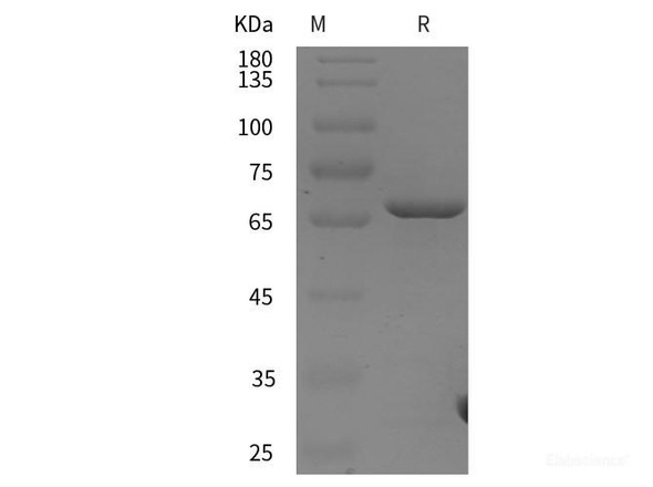 Human Annexin V Recombinant Protein (GST tag)