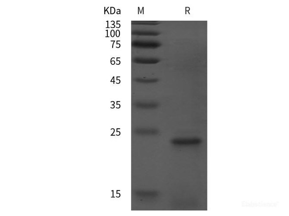 Human GADD45A Recombinant Protein (His tag)