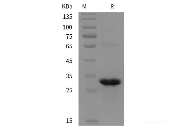 Human RAB5B Recombinant Protein (His tag)