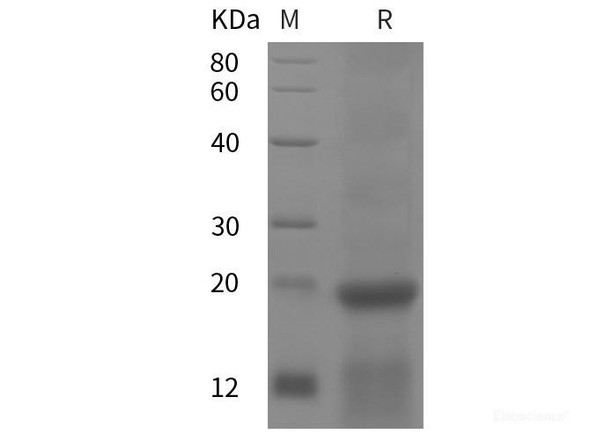 Human Ribosomal Recombinant Protein S25 Recombinant Protein (His tag)