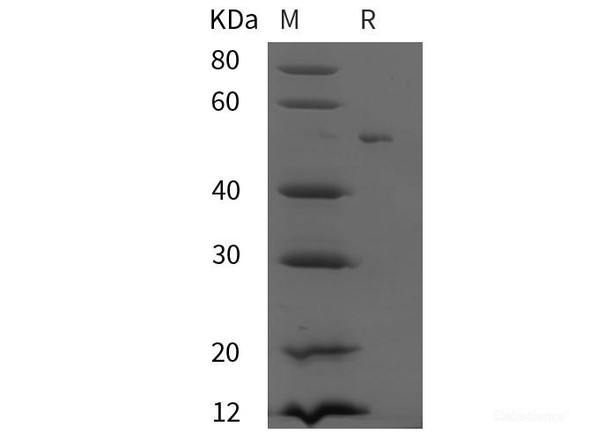 Human eIF4E Recombinant Protein (GST,His tag)
