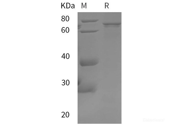 Human AKT1 Recombinant Protein (SUMO,His tag)