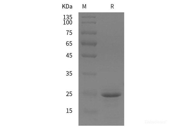 Mouse CD146/MCAM Recombinant Protein (His tag)