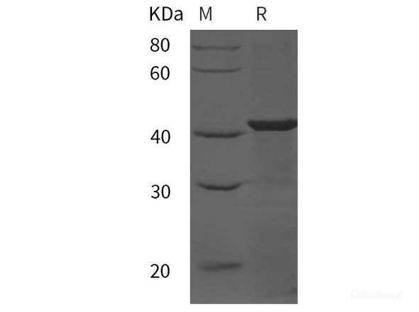 Mouse Prostatic Acid Phosphatase/ACPP Recombinant Protein (His tag)