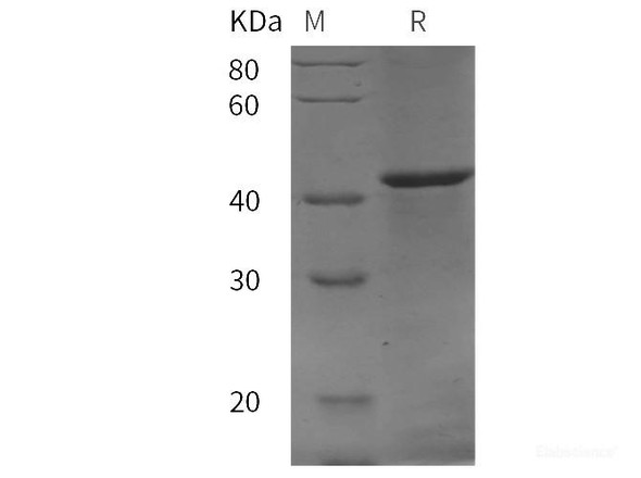 rat Prostatic Acid Phosphatase/ACPP Recombinant Protein (His tag)