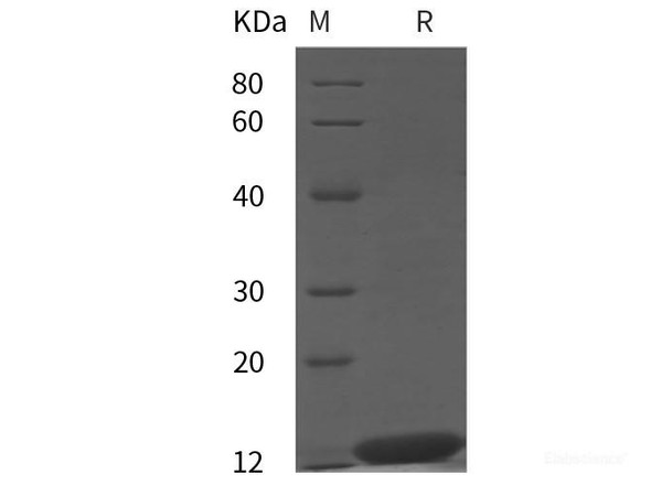 Monkeypox virus MPXV（A29L） Recombinant Protein (His tag)