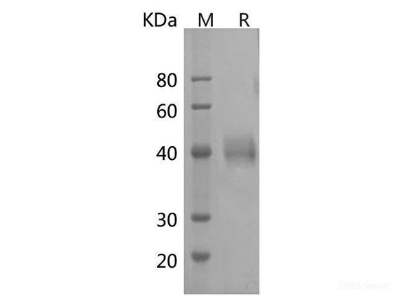 Human MICB Recombinant Protein (His Tag) (Active)