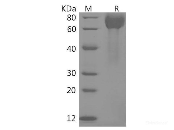 Human B7-H3/CD276 Recombinant Protein (His Tag)