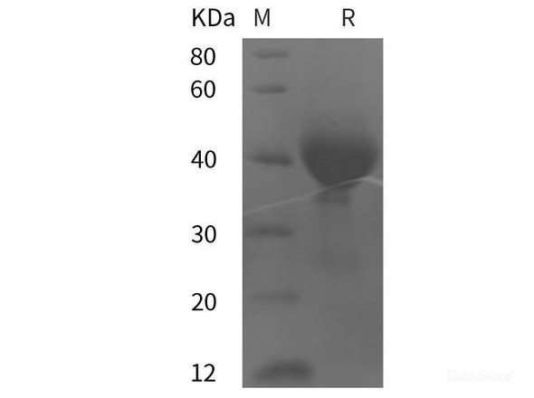 Human Tissue Factor/CD142 Recombinant Protein (His tag)