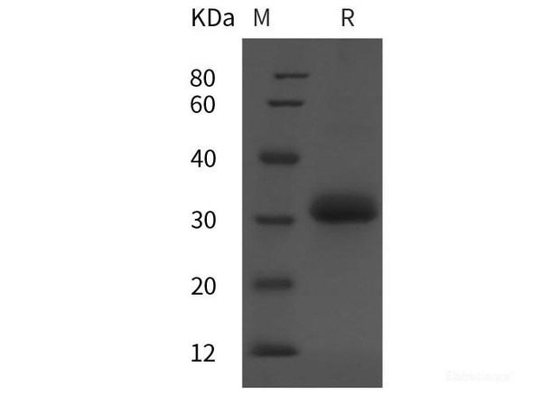 Human IGFBP-7 Recombinant Protein (His tag)