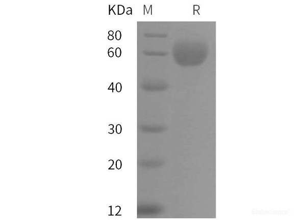 Human ApoH Recombinant Protein (His tag) (RPES6051)