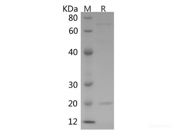 Human CTLA-4/CD152 Recombinant Protein (His tag)